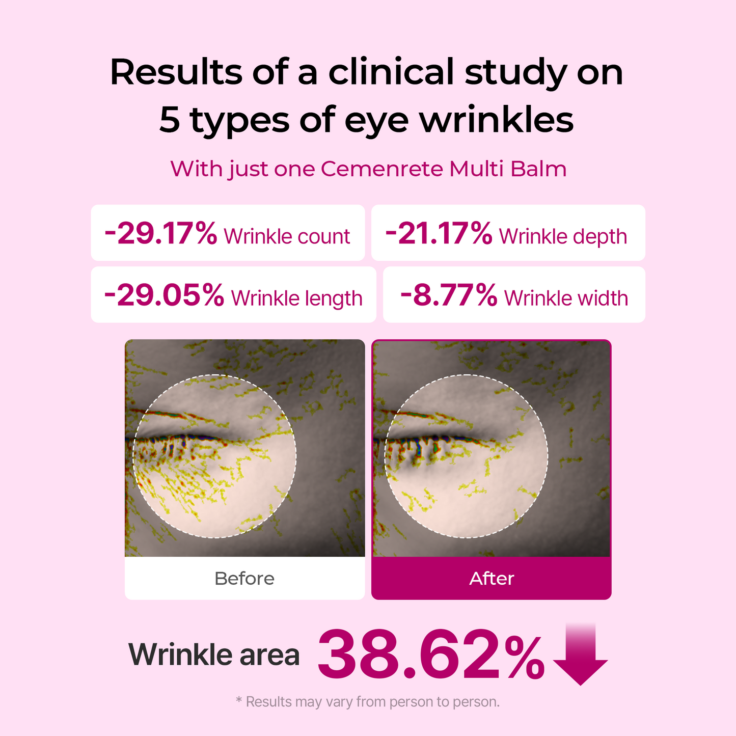 70%OFF✨Cemenrete Calcium Multi Balm | Anti-aging, Sagging, Wrinkles | Korean Cosmetics💖