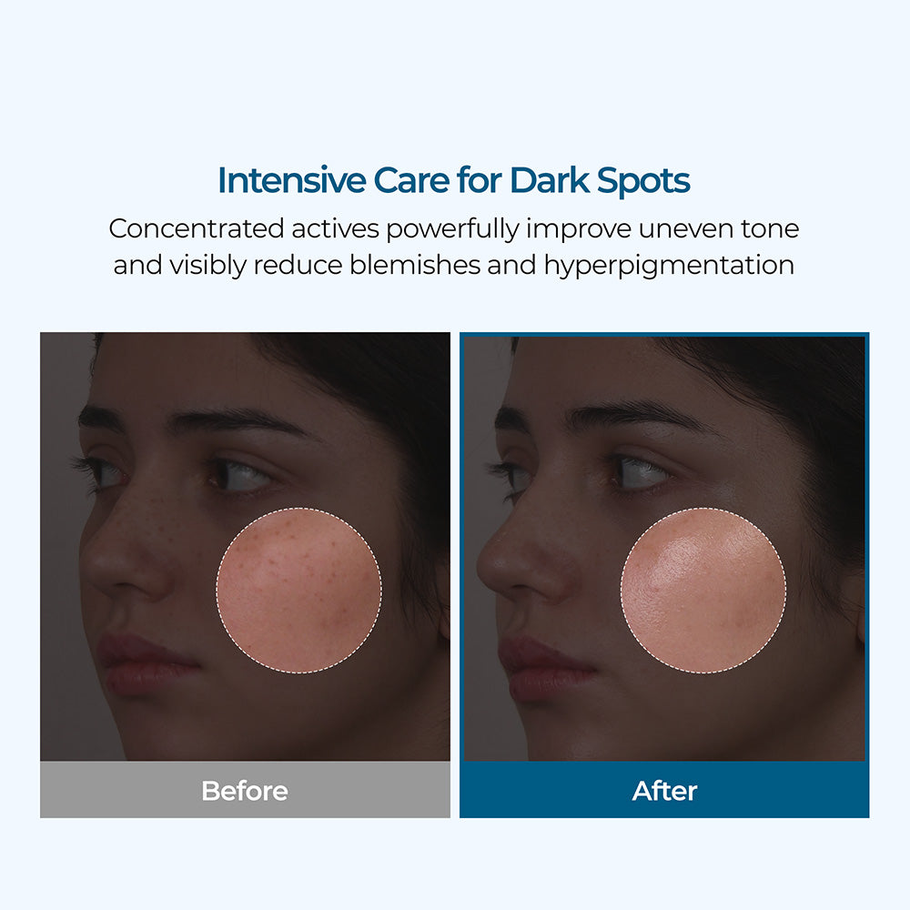 🔥Final 3 Hours: 40%OFF🔥 Dr.Alisanda Cream -for Dark Spots & Hyperpigmentation