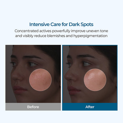 🔥Final 3 Hours: 40%OFF🔥 Dr.Alisanda Cream -for Dark Spots & Hyperpigmentation