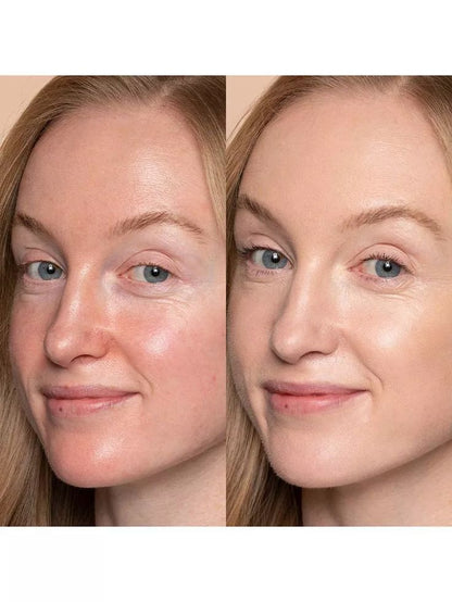 （✨LAST DAY 65 % OFF✨）ANTI-WRINKLE SKINCARE SET Eye Cream + Neck Cream-Perfect Duo