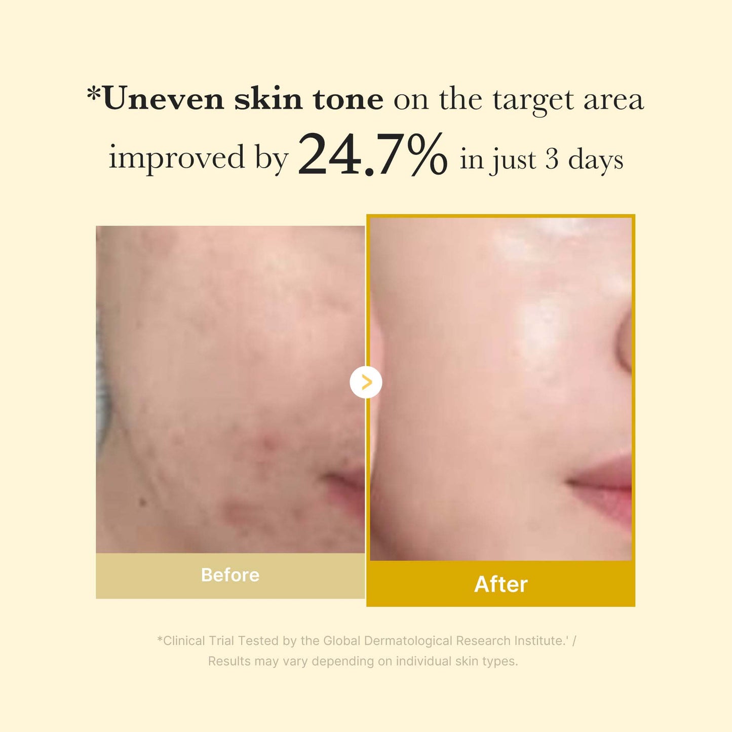 ✨✨Limited-time special offer: BUY ONE, GET ONE FREE!🔥🔥BBOJI Turmeric Kojic Acid Collagen Night Mask