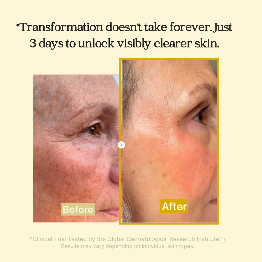 ✨✨Limited-time special offer: BUY ONE, GET ONE FREE!🔥🔥BBOJI Turmeric Kojic Acid Collagen Night Mask