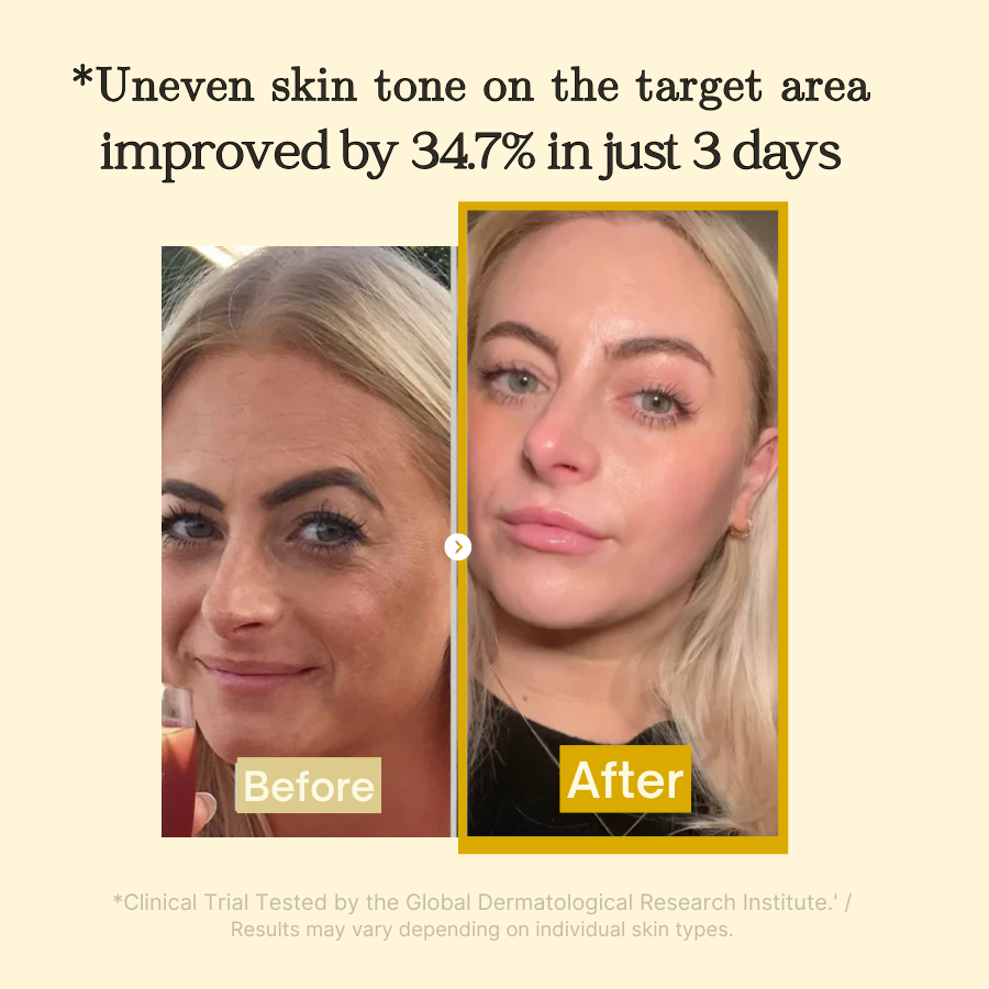 ✨✨Limited-time special offer: BUY ONE, GET ONE FREE!🔥🔥BBOJI Turmeric Kojic Acid Collagen Night Mask