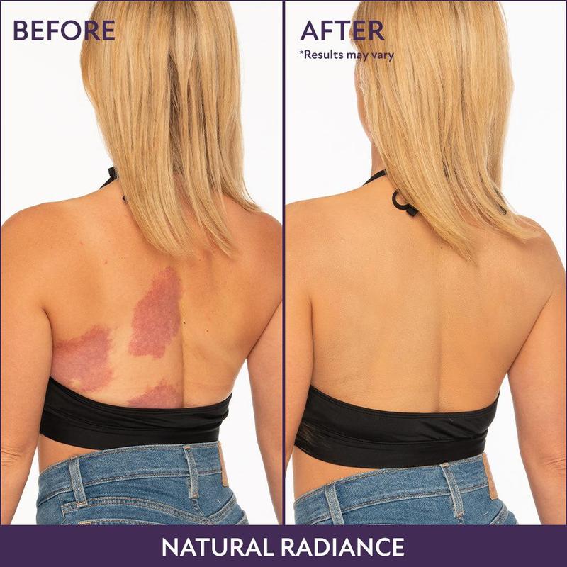 🎉Last Day 49% Off🎁 - Beauty Body Coverage Perfector with Brush🍎
