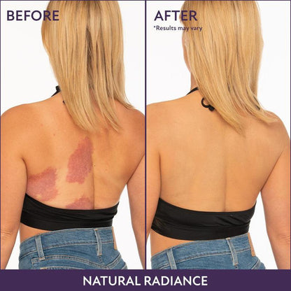 🎉Last Day 49% Off🎁 - Beauty Body Coverage Perfector with Brush🍎