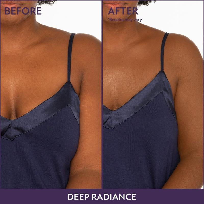 🎉Last Day 49% Off🎁 - Beauty Body Coverage Perfector with Brush🍎